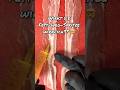 Does The Fat Removal Injection Really Work