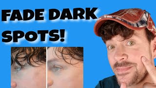 Fade Dark Spots On Face Fast! | Acne Spots, Brown Spots, Acne Scars 😯 CHRIS GIBSON