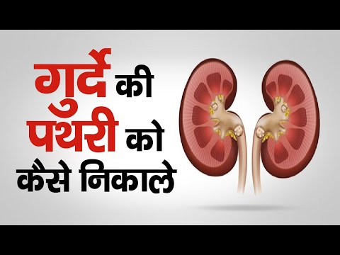 Cipzer stone breaker syrup, 100 ml