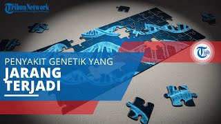 Alkaptonuria, Salah Satu Penyakit Langka dan Merupakan Penyakit yang Menurun