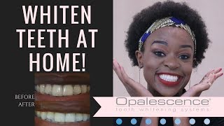 HOME Teeth Whitening with Opalescence Go | REVIEW | South African Beauty Blogger Laurina Machite