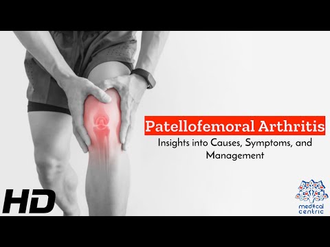 Effects of Cannabis on your body