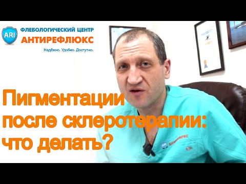 Пигментация на коже лица темные пятна Сосудистая пигментация на лице