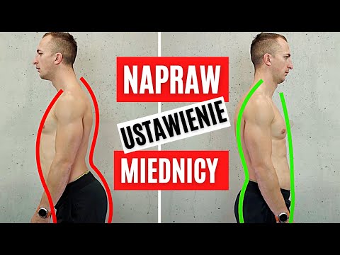 Arched Lower Back and a Protruding Stomach? Fix Hyperlordosis in 7 Steps