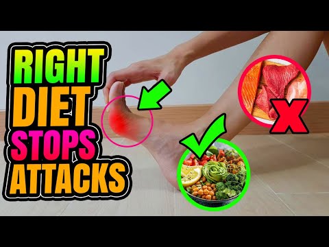 How To Treat GOUTS With Your Diet.