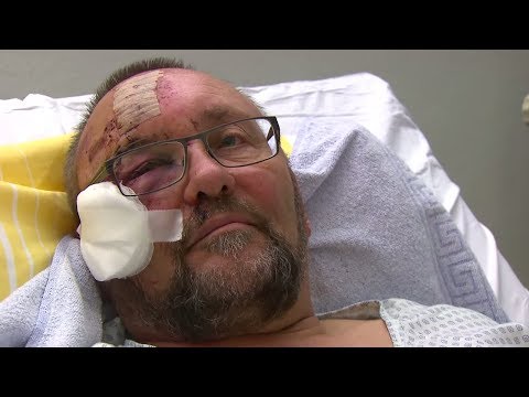 "DIESE MINUTEN FEHLEN MIR": Frank Magnitz spricht über den Angriff