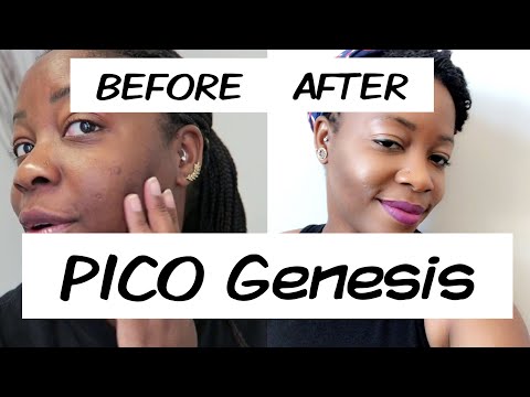 Pico Genesis