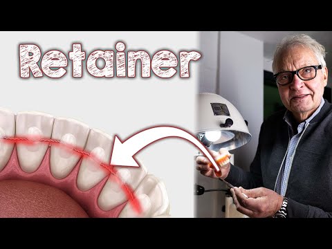 Retainer - Scheinbar harmlos - Tatsächlich aber mit negativen gesundheitlichen Folgen