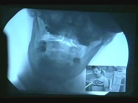 download lagu mp3 mp4 Moving X Ray, download mp3 Moving X Ray free downloadn, video klip Moving X Ray