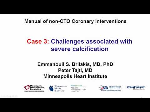 Case 3: PCI Manual - Challenges associated with severe calcification
