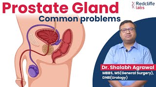 ✅ Prostate Gland and Urinary Problems Home Remedies | ✅ Prostate Gland Problems Symptoms & Treatment