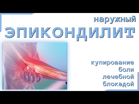 Крепеж для коленного сустава Лечение спины в кобеляках