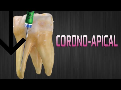 Corono Apical Manual