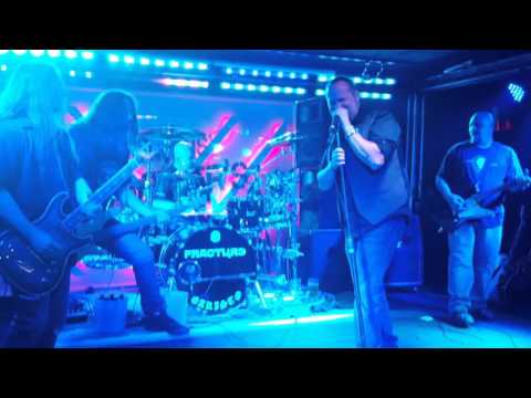 Tim Ripper Owens With Fracture
