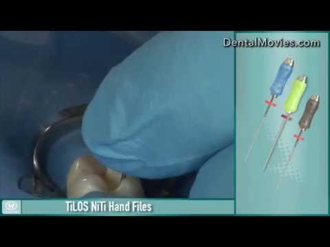 The leader in Minimally Invasive Endodontics - Endo EZE AET