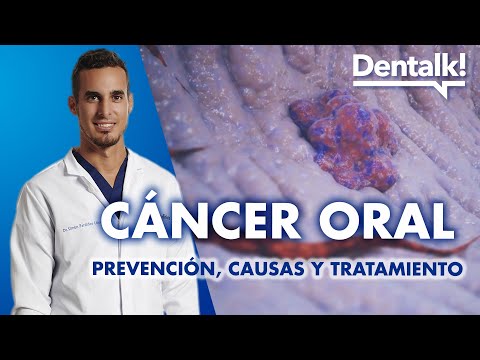Oral Cancer - Symptoms, Prevention and Treatment of Tongue and Oral Cancer | Dentalk! ©