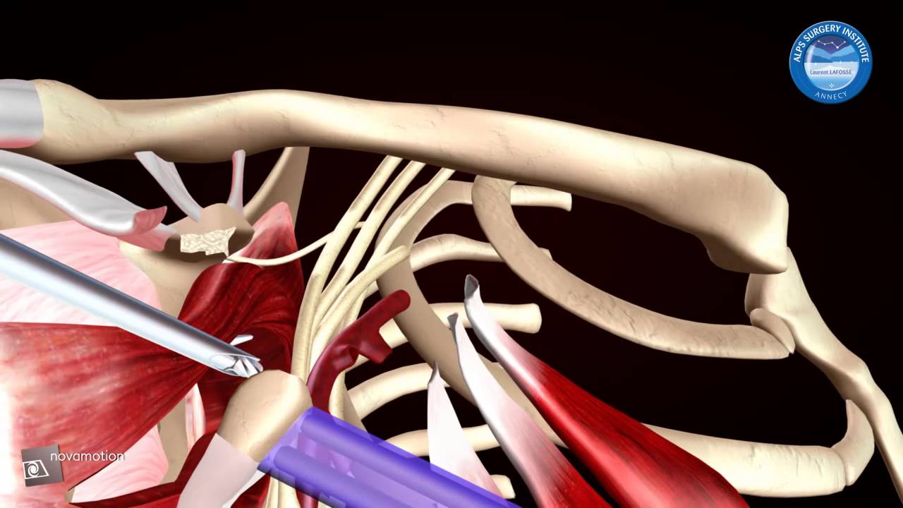 Marcus Vinicius Santos Martins-12