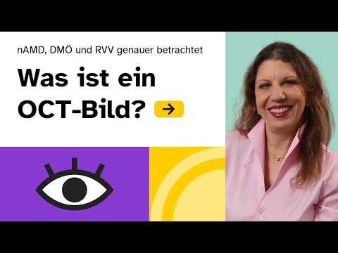 OCT: Diagnose und Kontrolle der nAMD (feuchte AMD), des DMÖ und des RVV