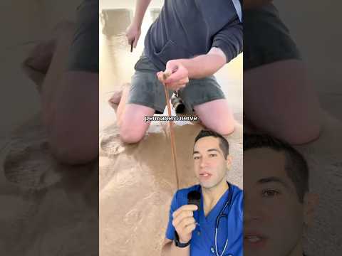 Doctor Reacts: sand worms?!