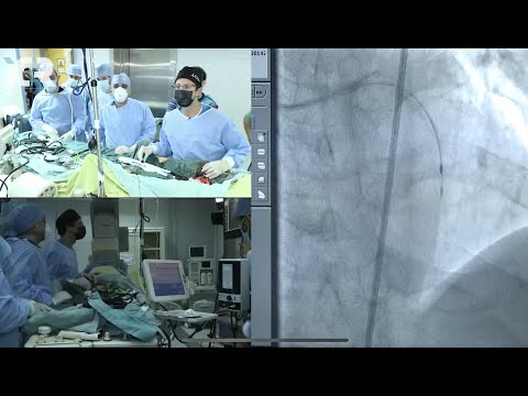 Rotablation live in a box case