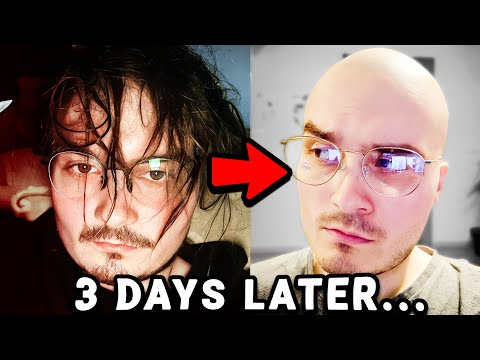 How I lost all my hair within 3 days...