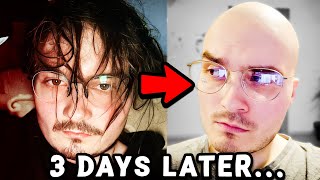 How I lost all my hair within 3 days...