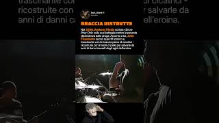 John Frusciante suonò con le braccia ricostruite dalla dipendenz