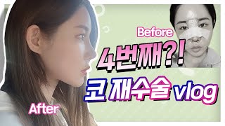 민효린 코가 되고 싶어 4번째 코재수술 V-log 2분 요약본