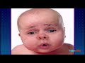 Afv Moment With 0 Context