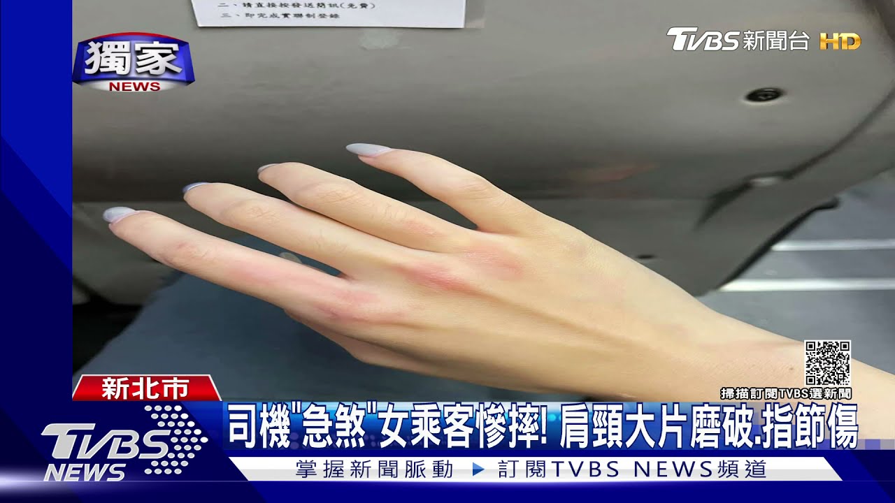 司機「急煞」女乘客慘摔! 肩頸大片磨破、指節傷