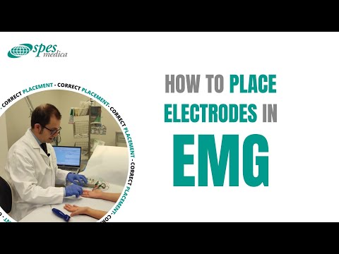 How to place electrodes to do an EMG