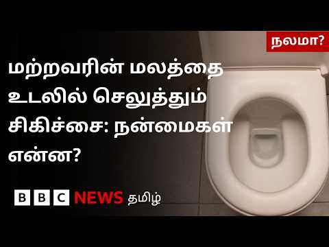 ஒருவர் மலத்தை வேறொருவர் உடலில் செலுத்தும் சிகிச்சை முறையின் வியக்க வைக்கும் பலன்கள்