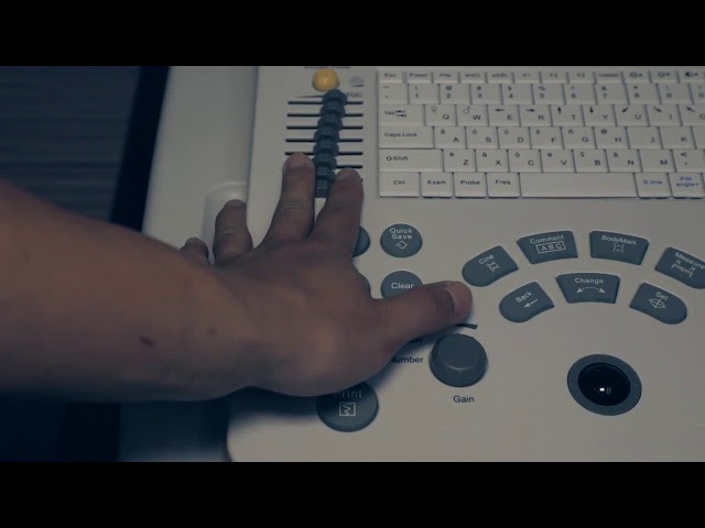 جهاز سونار ايدان ألتراساوندDUS60