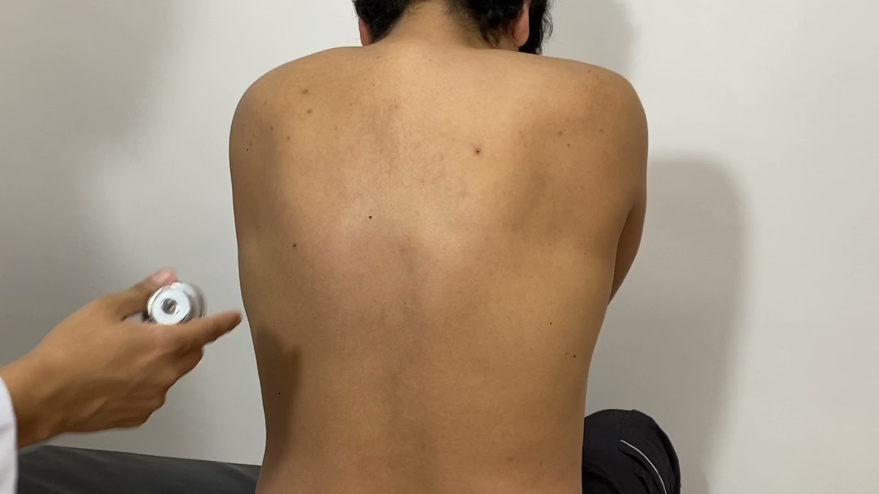 Examen físico del Tórax