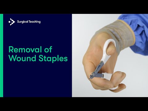 How to Remove Wound Staples