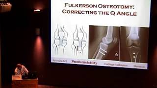 Orthopedic Update on Knee Arthroscopy  Pearls for Referring Physicians- Dr. Bryan Warme, 6/13/13