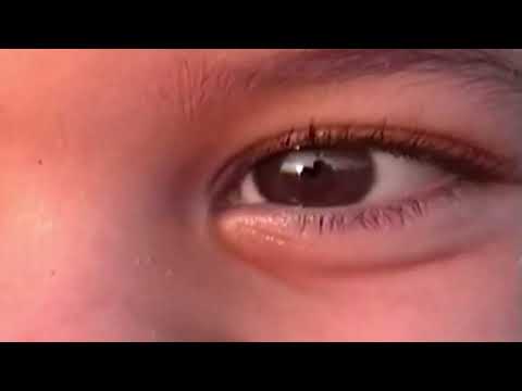 Video thumbnail for Interlude: Suse Millemann