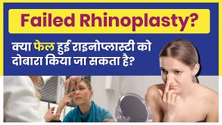 Failed Rhinoplasty surgery - क्या आपकी नाक वापस से नई बनाई जा सकती है? Revision Rhinoplasty |