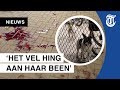 Oudere vrouw zwaargewond door hondenaanval