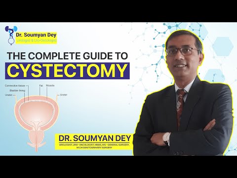 What is Cystectomy Or Bladder removal ? Life After Cystectomy | Bladder Cancer Treatment Thane India