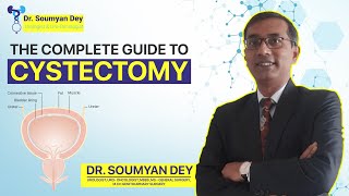 What is Cystectomy Or Bladder removal ? Life After Cystectomy