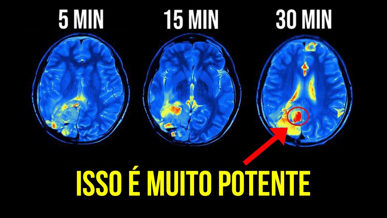 Isso Vai Revolucionar Sua Vida! (99,9% Das Pessoas Sentem Efeitos Positivos) | Wim Hof