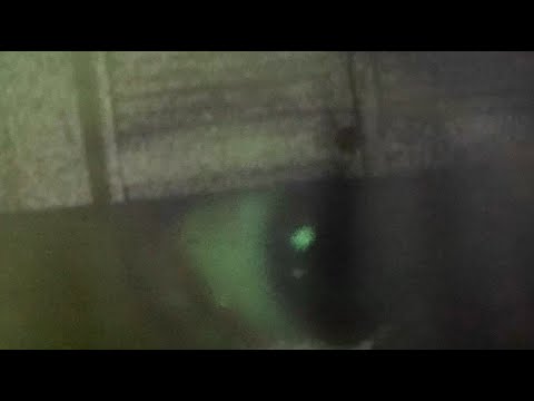 Video thumbnail for Ash Speck in a Green Eye