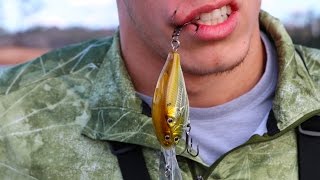 Травмы от рыболовного крючка