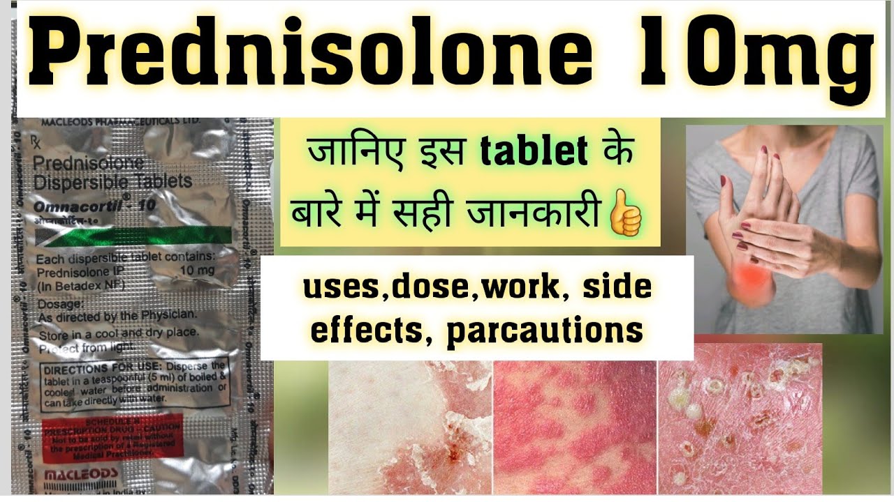 Watch video Omnacortil 10mg|| Prednisolone tablet || uses,dose,work,side effects पूरी जानकारी हिंदी में || Now Omnacortil 10mg|| Prednisolone tablet || uses,dose,work,side effects पूरी जानकारी हिंदी में ||