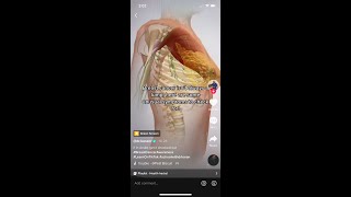 Unusual breast cancer symptoms #shorts