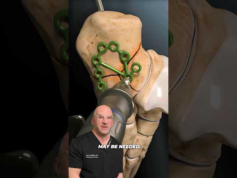 Most Painful Broken Bone⁉️ #shorts