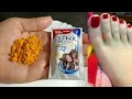 हाथ पैर धोते वक्त शैंपू में बस ये मिला�
