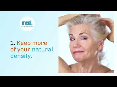 Hair Loss? The Sooner You Act, the Better - Medi Hair Loss & Scalp Clinic Canada