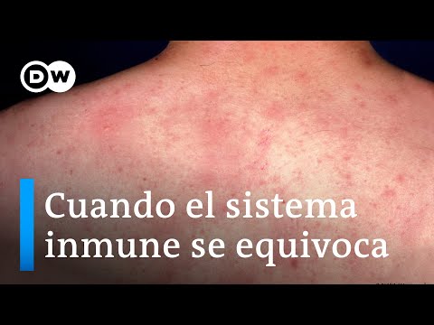 La alergia: un error del sistema de defensa del organismo